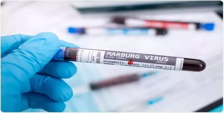  ما هو فيروس ماربورغ وما هي أعراضه؟ تفشيات ومخاوف إفريقية 