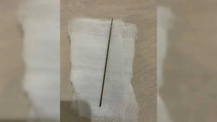 دمنهور تنقذ شاب حاول تسليك مجراه البولي بإبرة 750