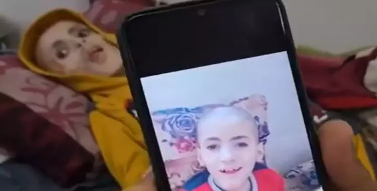  يزن الكفارنة.. صور مفزعة لطفل من غزة مات جوعا 