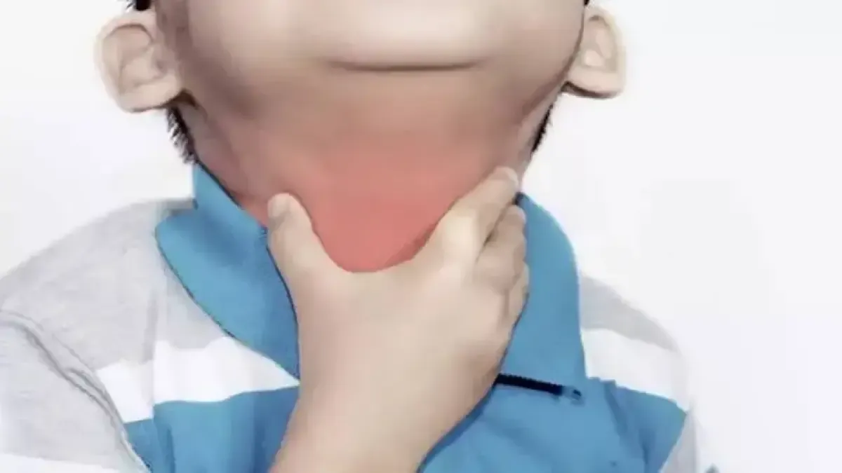ما هو فيروس الخناق الحنجري؟.. وزارة الصحة توضح